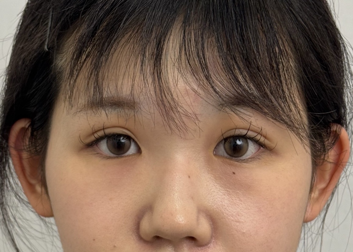 After