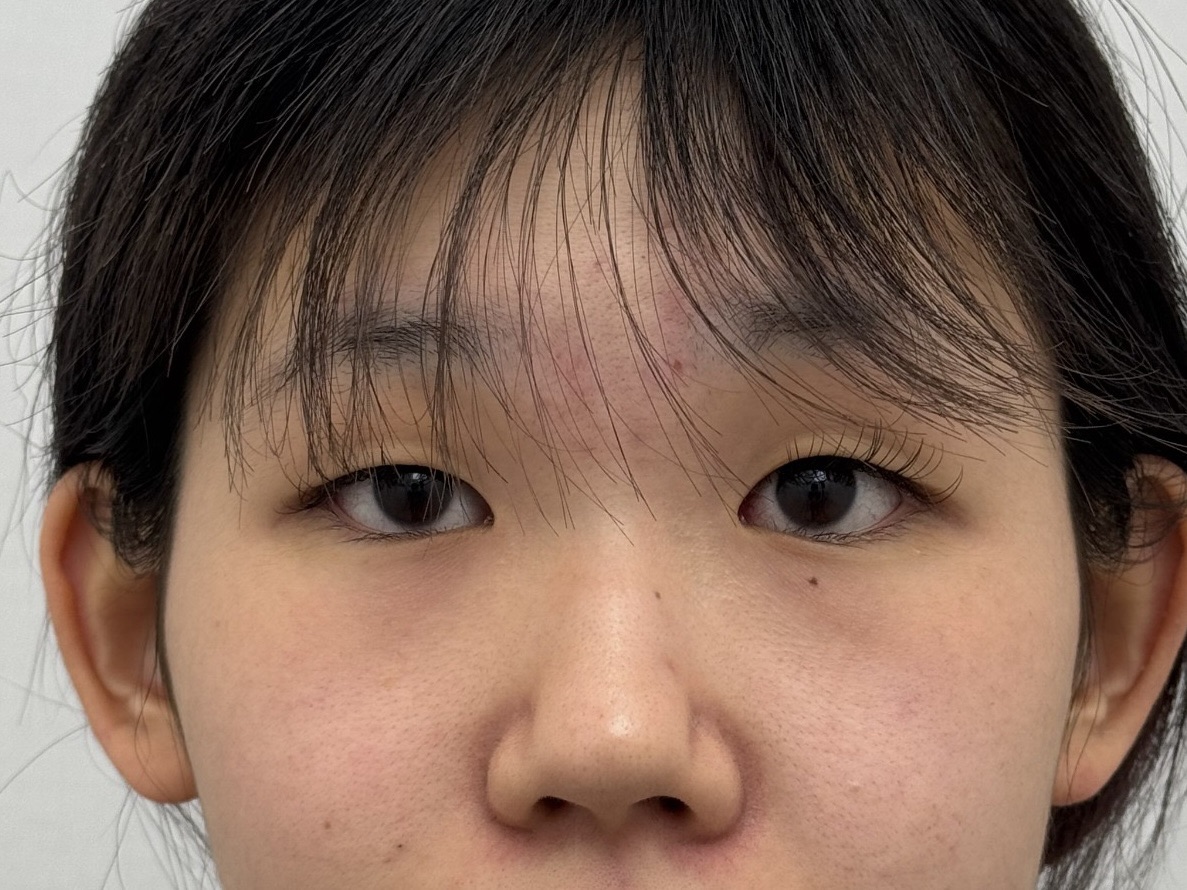 Before
