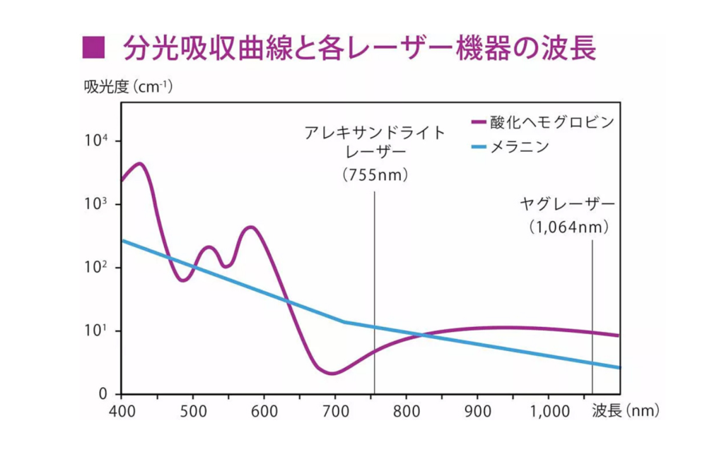 剛毛から産毛まで対応可能