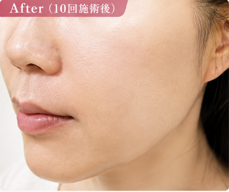 After